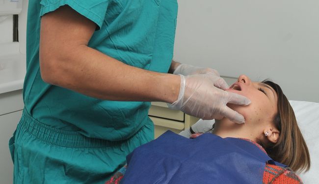 Mitos y verdades sobre los implantes dentales